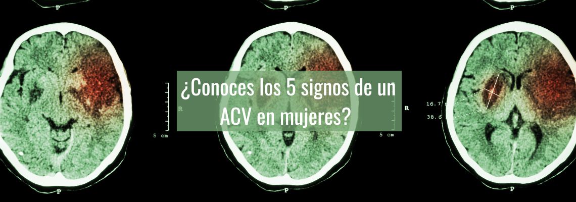 Conoce los 5 signos de un ACV en las mujeres en Casitodoonline