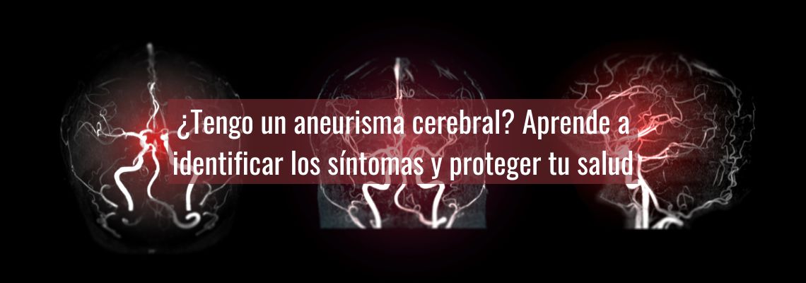 ¿Tengo un aneurisma cerebral? Aprende a identificar los síntomas y proteger tu salud