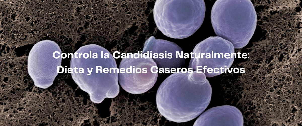 Información sobre la candidiasis en casitodoonline