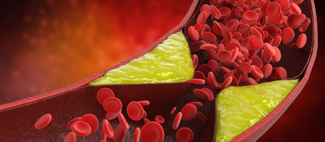 ¿Cómo Se Siente un Coágulo de Sangre? Una Guía Completa