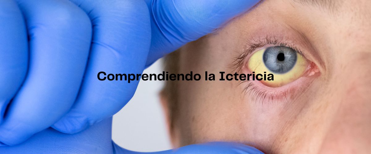Información de la ictericia en Casitodoonline