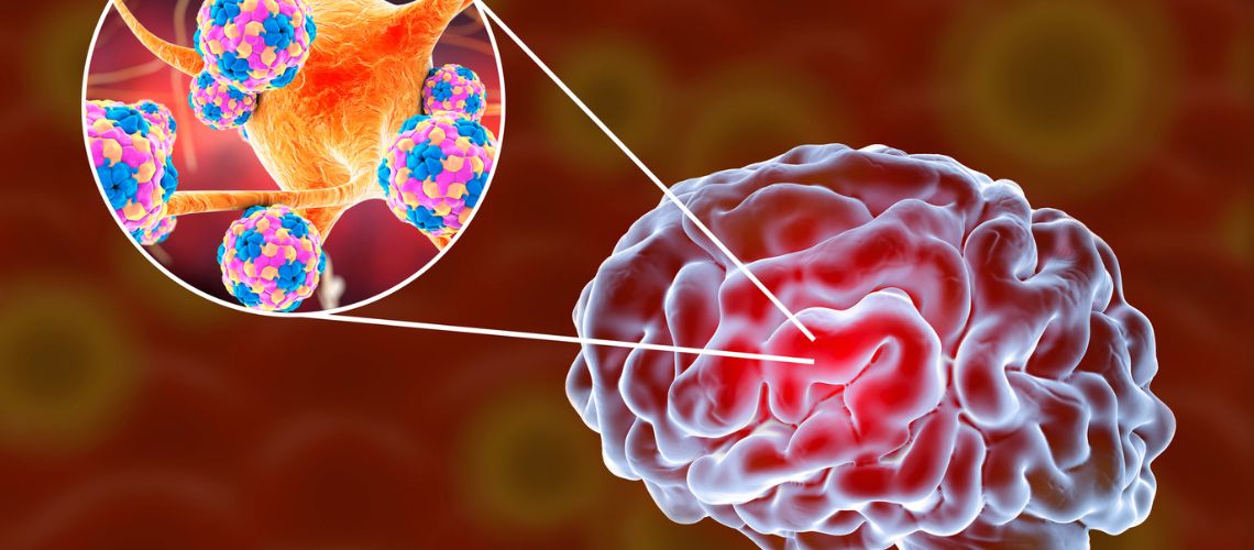 Meningitis en Casitodoonline