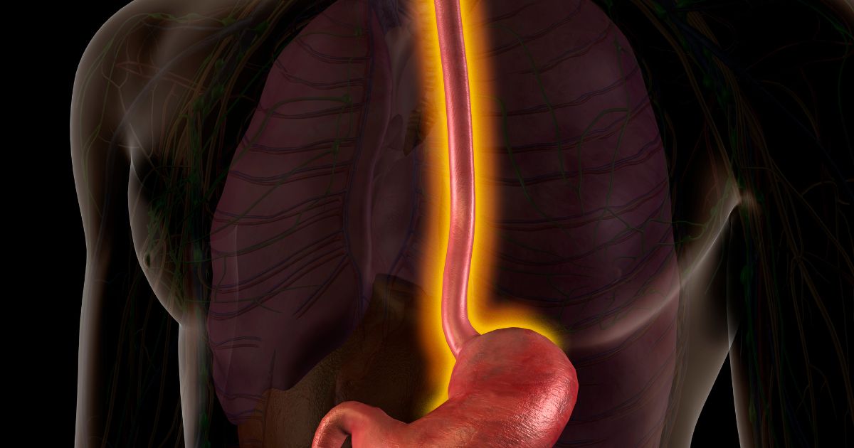 Várices esofágicas en Casitodoonline