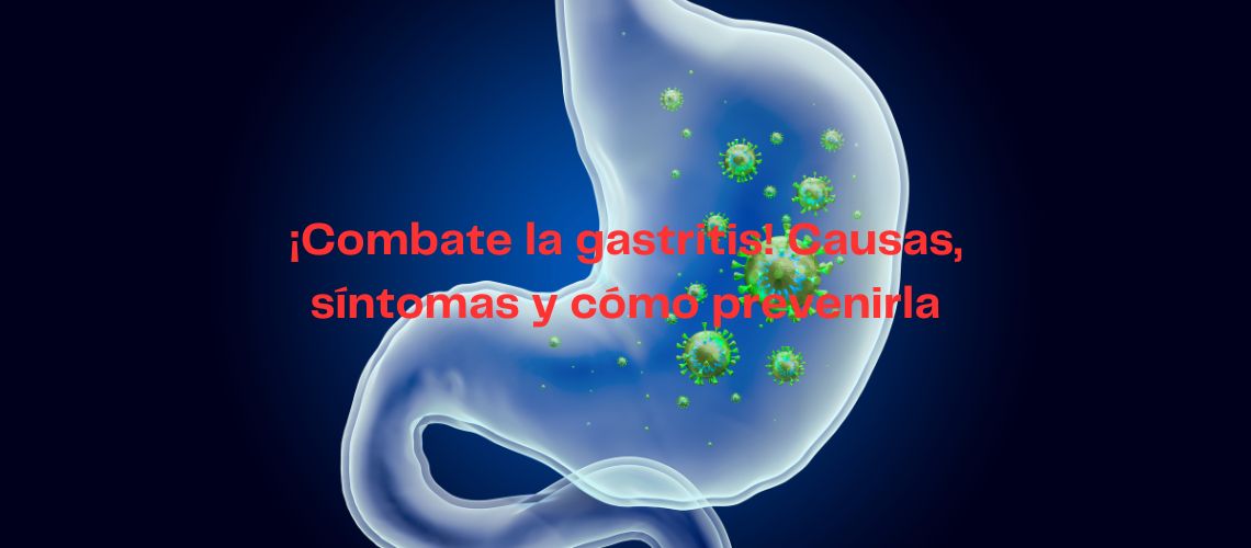 ¡Combate la gastritis! Causas, síntomas y cómo prevenirla de manera efectiva